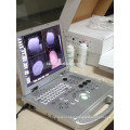 laptop ultrasound color doppler & color ultrasound laptop price